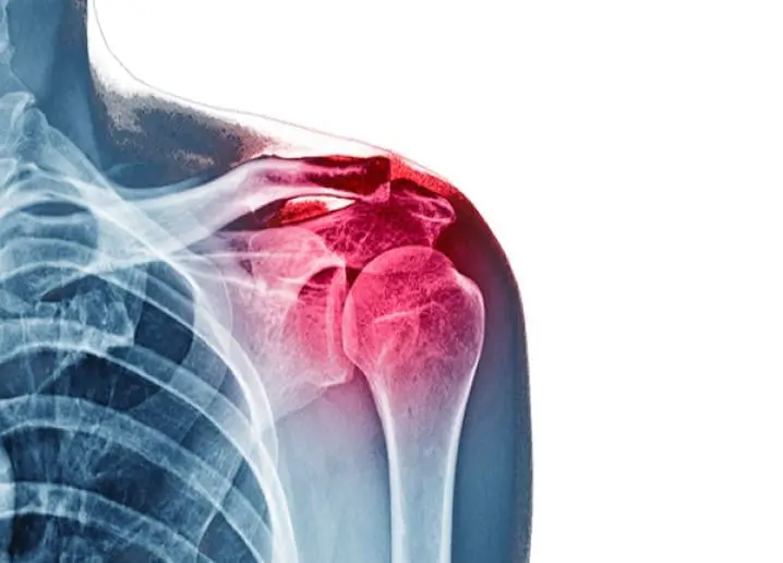 artroscopia-de-rodilla