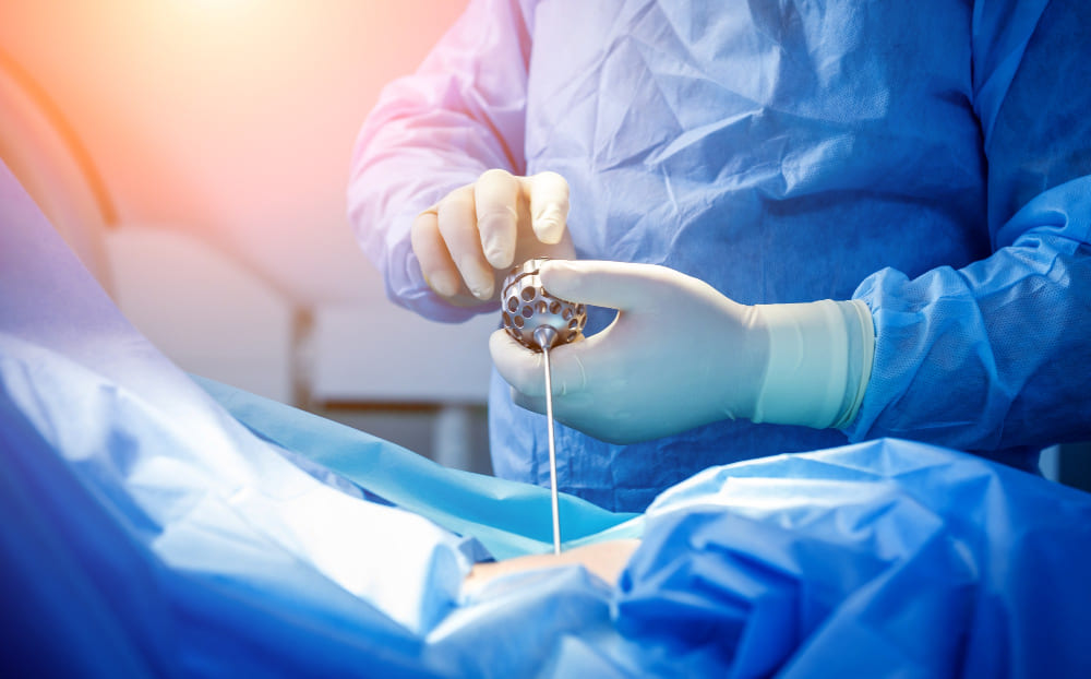 Tratamiento para hernias discales en Querétaro